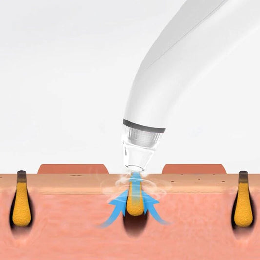 PureGlow Diamond Pro — Electric Blackhead Remover & Pore Vacuum Cleaner