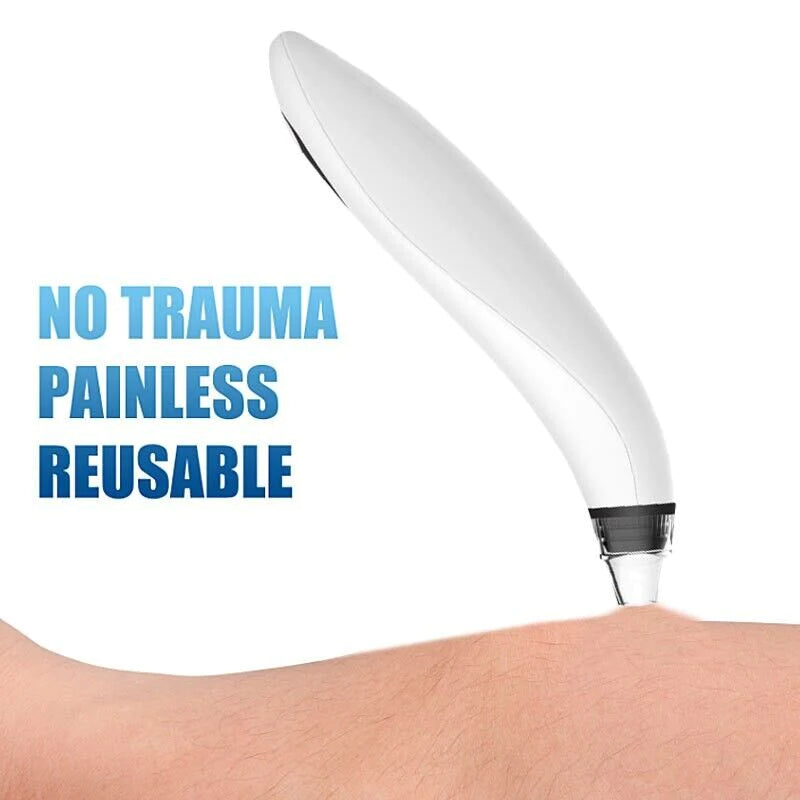 PureGlow Diamond Pro — Electric Blackhead Remover & Pore Vacuum Cleaner