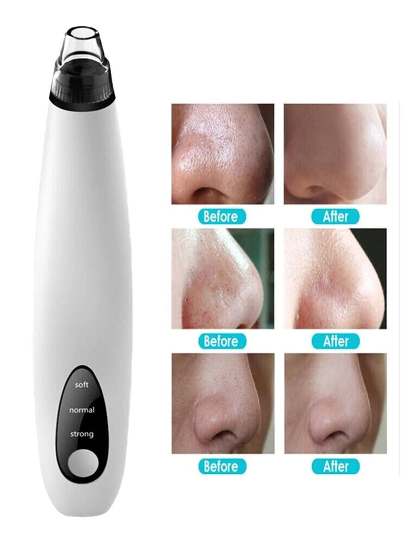 PureGlow Diamond Pro — Electric Blackhead Remover & Pore Vacuum Cleaner